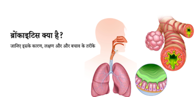 Bronchitis in hindi