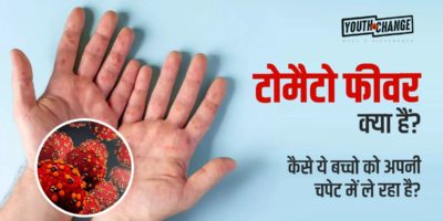 tomato fever in hindi